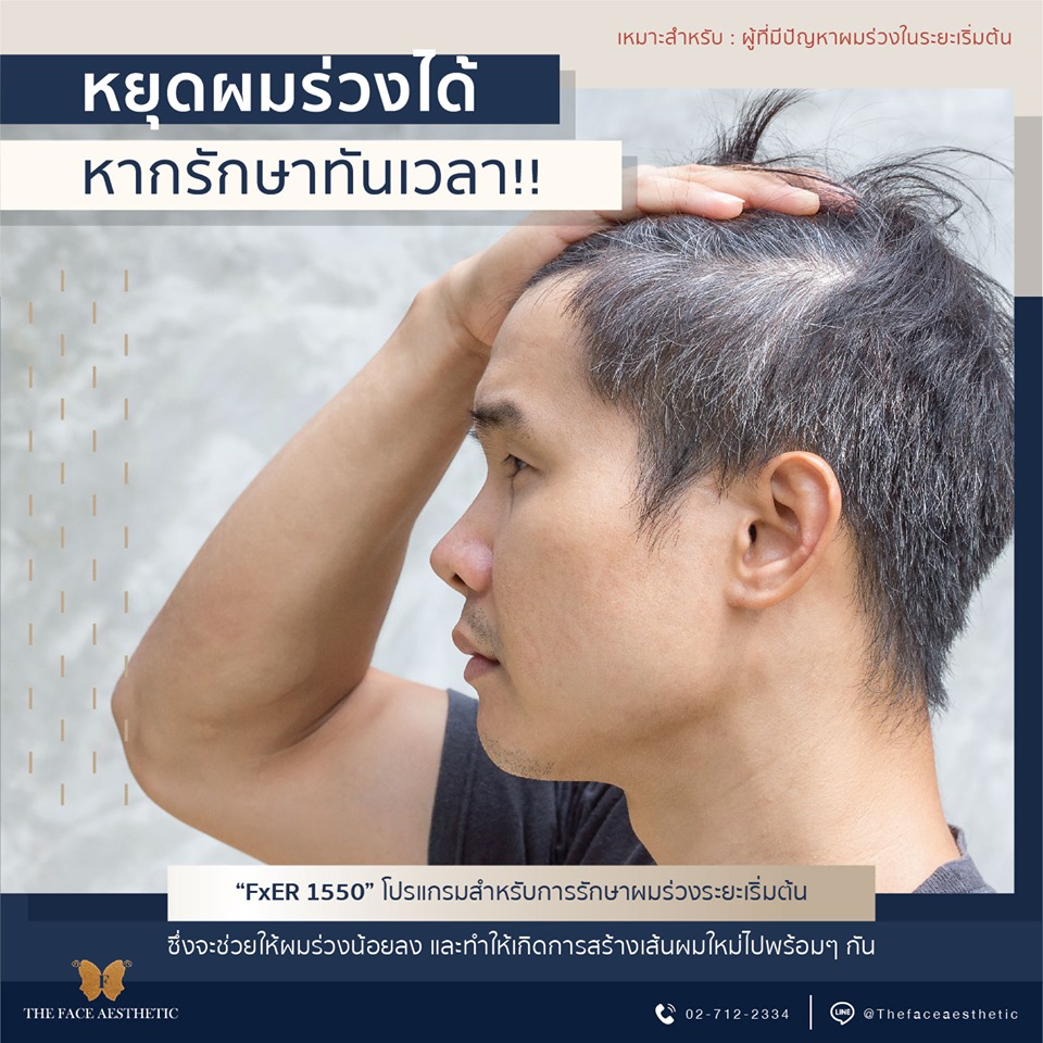 ผมร่วง รักษาได้ ถ้ารักษาเร็ว !!!!
