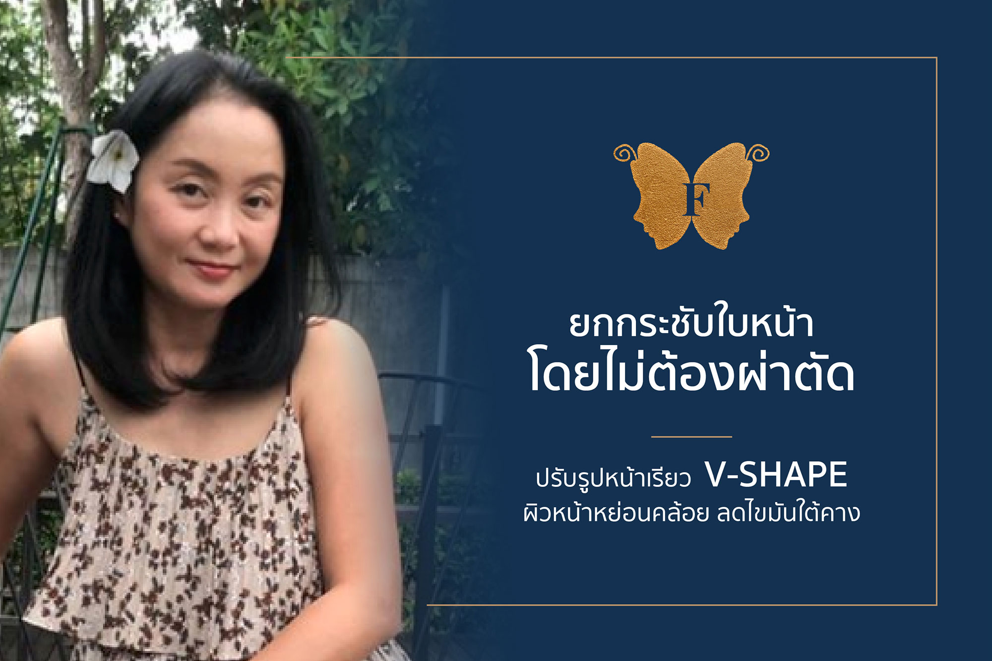 ยกกระชับใบหน้าโดยไม่ต้องผ่าตัด