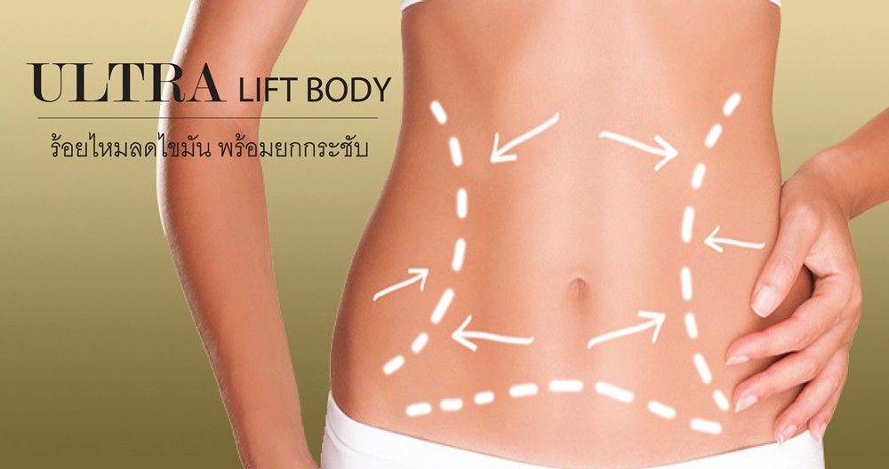 Ultra Lift Body (HIFU technology)